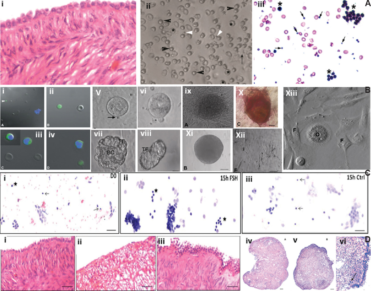 Stem cells in adult mammalian ovary. (A) (i) Adult aged human ovary showing prominent ovary surface epithelial (OSE) cells with no follicles in the ovarian cortex, (ii) gentle scraping of ovary surface epithelial cells show the presence of spherical stem cells of two distinct sizes including very small embryonic-like stem cells (white arrow) and slightly bigger OSCs (black arrow) along with red blood cells, (iii) after H&E staining, very small embryonic-like stem cells (arrow) and OSCs (*) along with germ cell nest are clearly visualized. Source: Reproduced with permission from Refs 6364. (B) (i-iv) Confocal images of stem cells expressing OCT-4, (v-vi) OSCs in culture spontaneously differentiate into oocyte-like structures, polar body extrusion is also observed, (vii-viii) Parthenote embryo and hatching blastocyst in culture, (ix-x) embryonic stem-like colony, positive for alkaline phosphatise, (xi) embryoid body-like structure, (xii) neuronal-like structures, (xiii) at places, somatic fibroblasts surround an oocyte-like structure giving an impression of primordial follicle-like structure. Source: Reproduced with permission from Ref. 63. (C) Sheep ovary surface epithelial cells smear shows the presence of VSELs (arrow) and OSCs (*) along with large number of epithelial cells, (ii) 15 h of follicle-stimulating hormone treatment resulted in extensive proliferation of stem cells and formation of germ cell nests whereas, (iii) untreated control did not show any change compared to initial culture. Source: Reproduced with permission from Ref. 65. (D) (i) Prominent single layer of ovary surface epithelial and stroma devoid of follicles in peri-menopausal ovarian tissue, (ii) loss of epithelial cells and disorganized stroma evident after three days in culture, (iii) follicle-stimulating hormone treatment results in proliferation and multi-layered appearance of ovary surface epithelial cells, (iv) chemoablated mouse ovary devoid of follicles, (v-vi) prominent ovary surface epithelial after follicle-stimulating hormone treatment to chemoablated mouse. Source: Reproduced with permission from Refs 6667.